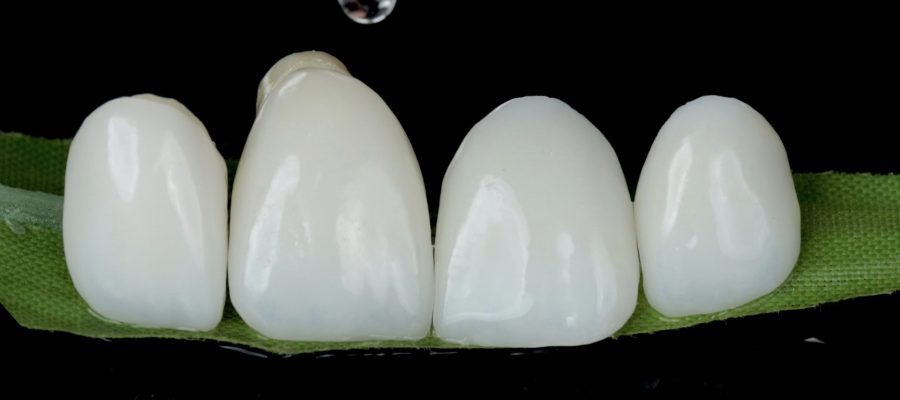 Lentes de contato dental .004